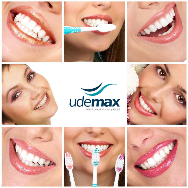 sonrisas udemax