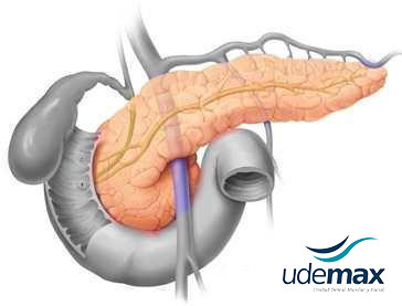 cancer pancreas