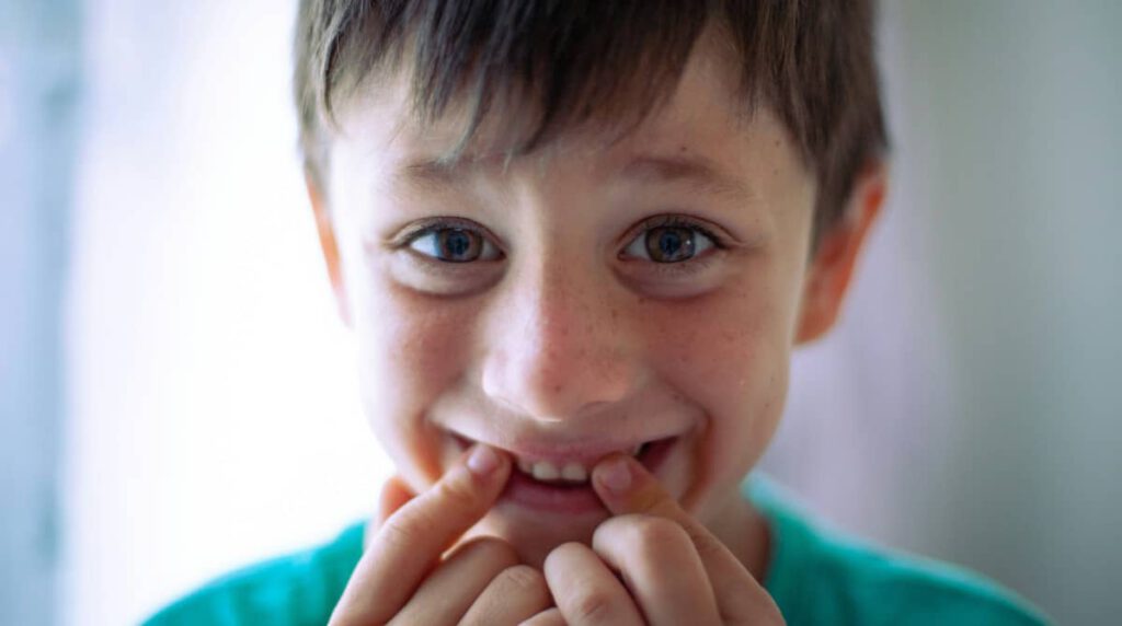 children smiling with their milk teeth