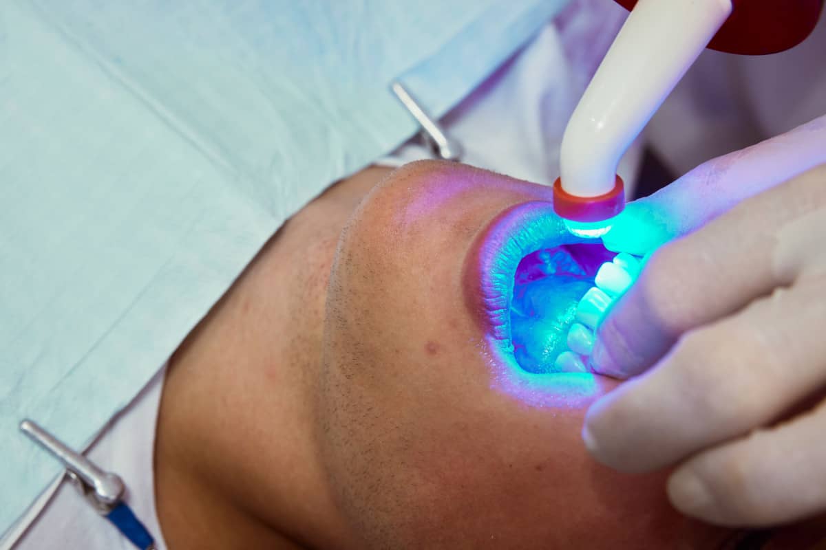 Láser dental